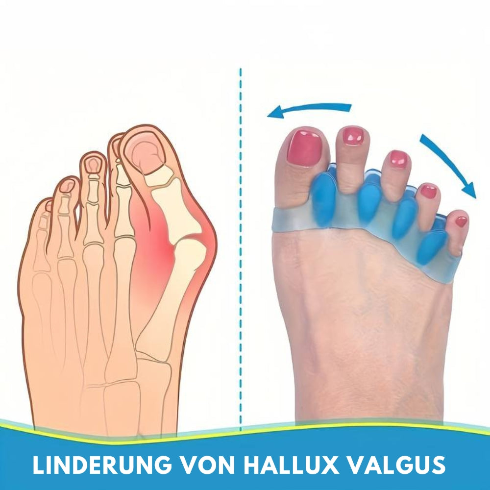 Zehentrenner Zehenspreizer aus Silikon